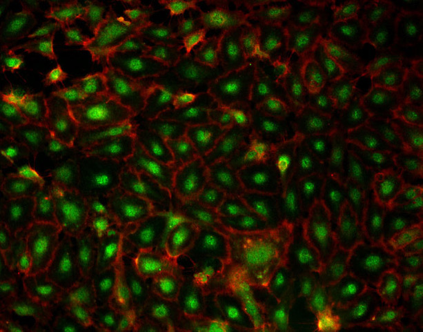 Cultured human dermal lymphatic endothelial cells stained for the transcription factor Prox1 <em>(green)</em> and the adhesion molecule CD31 <em>(red)</em>.