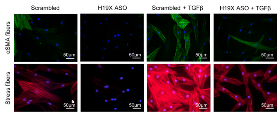 The effect of H19X knock-down on myofibroblast development induced by TGFβ. Myofibroblasts were characterized by αSMA and stress fiber immunofluorescence staining (Pachera et al., <em>J Clin Invest</em>, 2020).