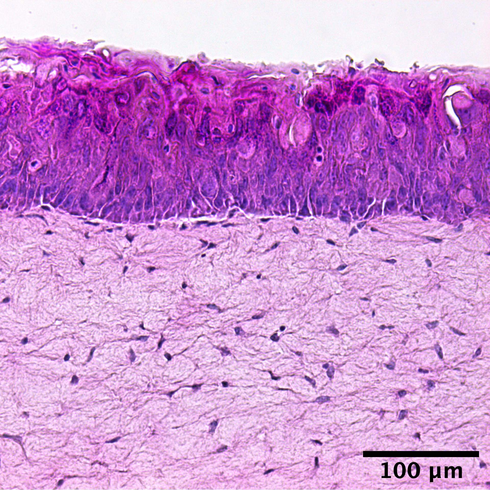 Hematoxylin & eosin staining of a tissue engineered skin model mimicking the epidermal and dermal layer of native skin.