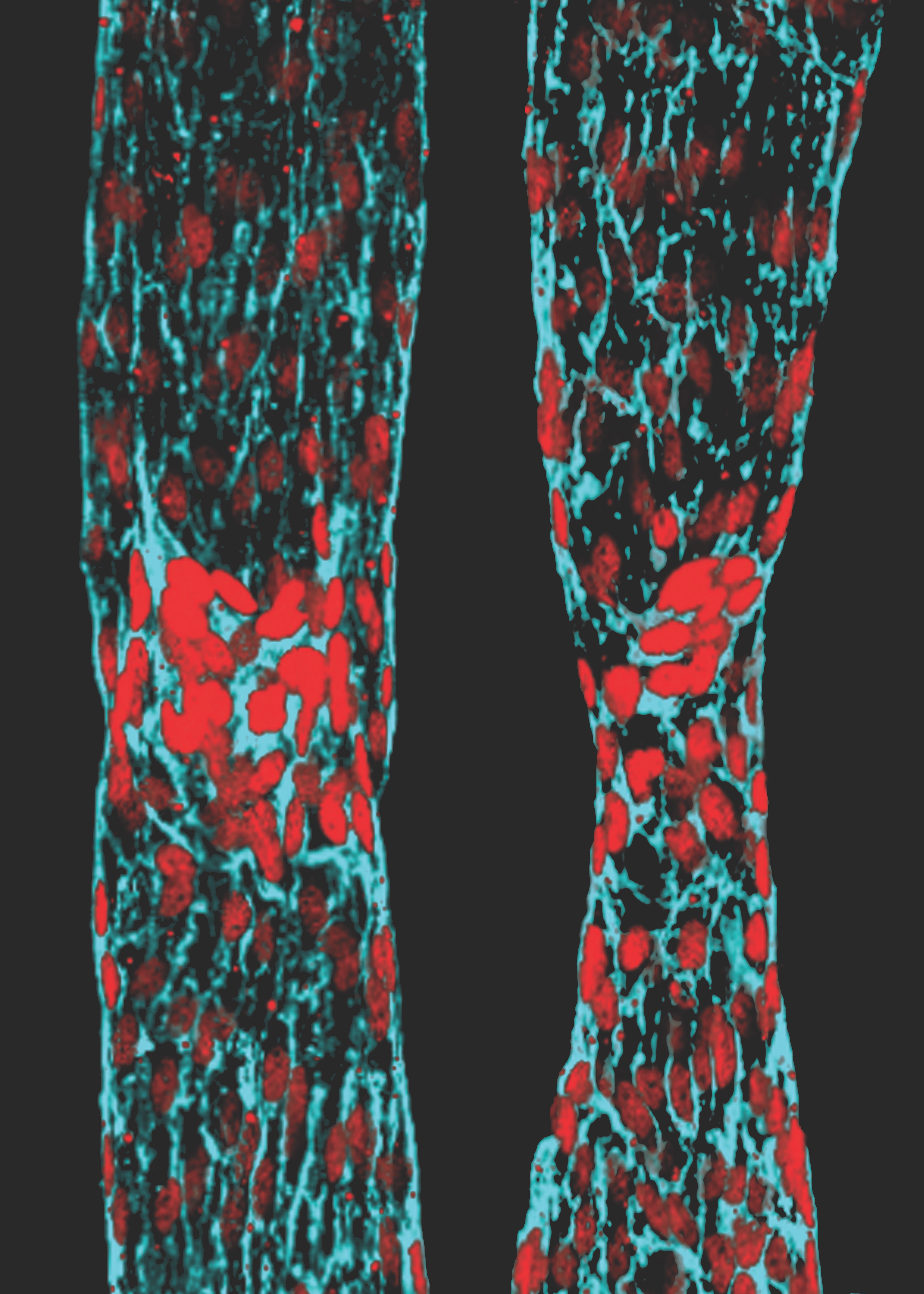Lymphatic collecting vessels (© Amélie Sabine).