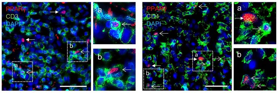 Detection of PPAR-γ<sup>+</sup> T helper cells in human allergic contact dermatitis: (A+B) Representative pictures of immunofluorescence for PPAR-γ and CD3 (A) or CD4 (B) in lesional skin of acute allergic contact dermatitis. Scale bars: 50 μm. Open arrows: PPAR-γ<sup>+</sup>/CD3<sup>+</sup> cells (A) or PPAR-γ<sup>+</sup>/CD4<sup>+</sup> cells (B). Closed arrows: PPAR-γ<sup>+</sup>/CD3<sup>-</sup> cells (A) or PPAR-γ<sup>+</sup>/CD4<sup>-</sup> cells (B).