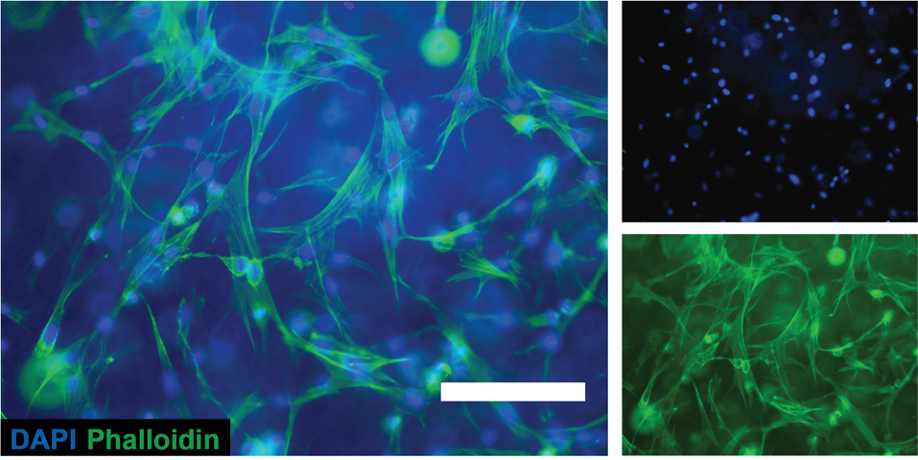Merged wide-field fluorescence image of primary human dermal fibroblasts encapsulated in 3D hydrogels, 4 days after encapsulation. The cells were labelled for F-actin with Alexa Fluor 488-phalloidin (green) and DNA (nucleus) with DAPI (blue). Scale bar, 150 μm. (Image credit: O. Dudaryeva, N. Moro).